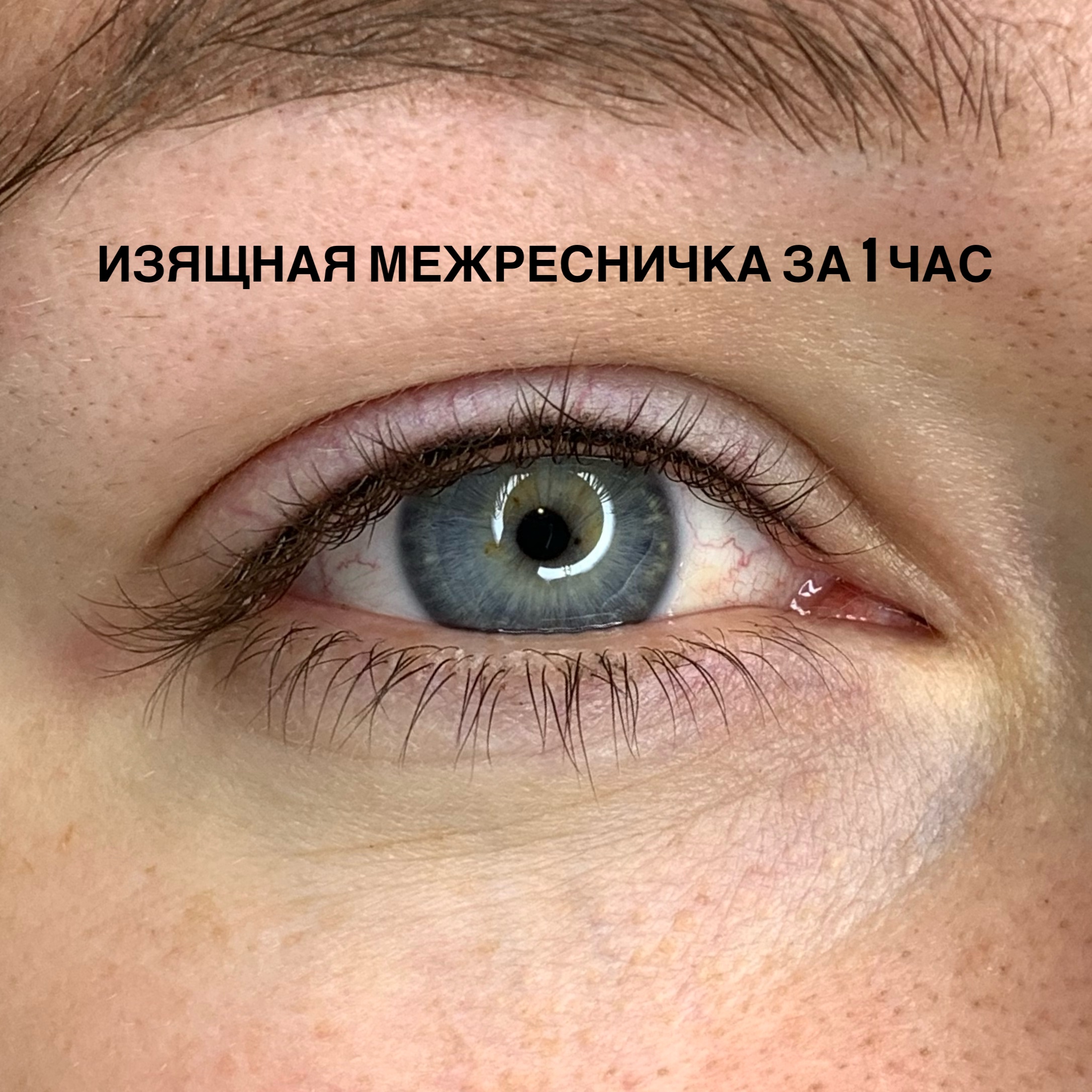 Межресничка